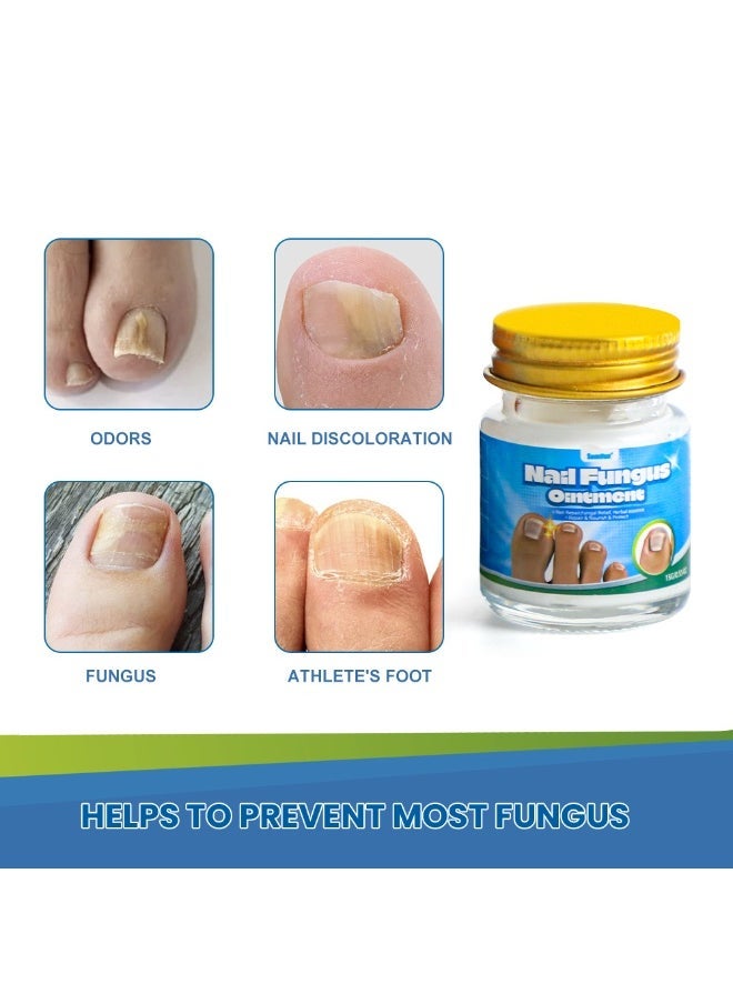 Sumifun مرهم فطريات الأظافر 3 قطع، كريم إصلاح الأظافر بقوة إضافية، كريم علاج فطريات أظافر القدم، ينظف وينعم الأظافر، يصلح البكتيريا 15غ*3 - Image 5