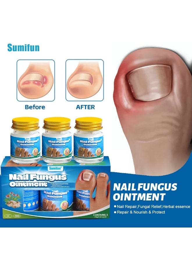 Sumifun مرهم فطريات الأظافر 3 قطع، كريم إصلاح الأظافر بقوة إضافية، كريم علاج فطريات أظافر القدم، ينظف وينعم الأظافر، يصلح البكتيريا 15غ*3 - Image 1