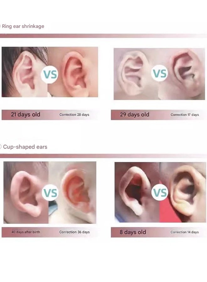 Baby Ear Corrector Set Soft Silicone Brace + Clip + Tape  Ear Deformity Correction - Image 2