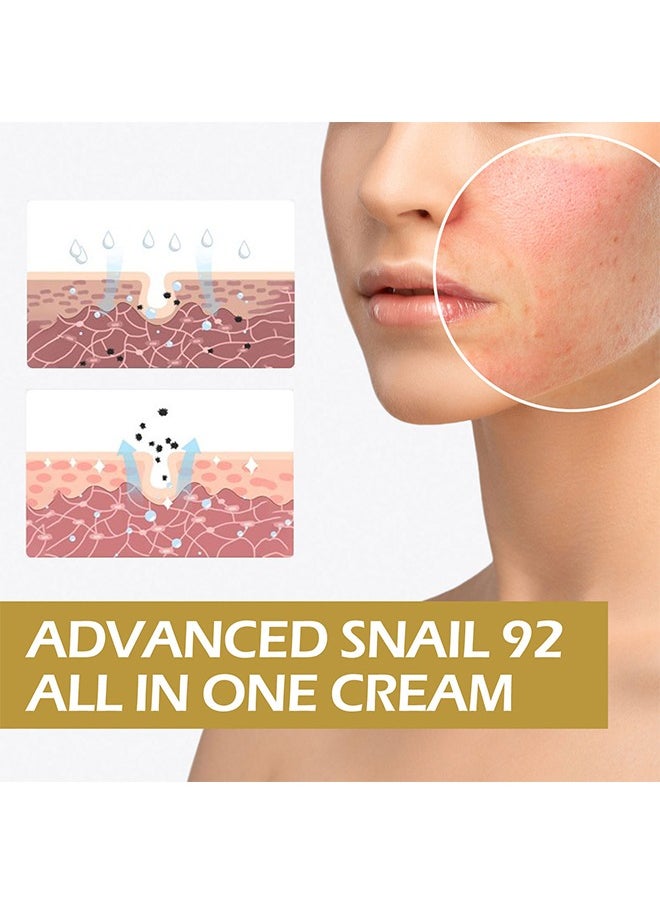 Snail Essence Cream - With Snail Secretion Filtrate, Moisturizing Acne Scar Removal Cream Improve Skin Nourishing Collagen Essence Cream For Improve Damaged Skin