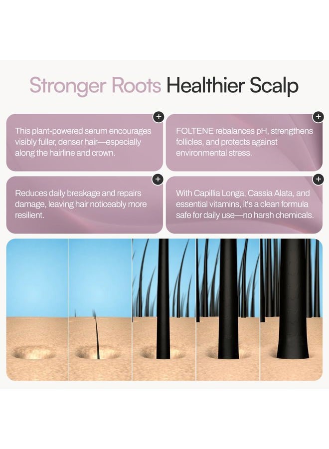 Foltene Pharma Hair and Sculp Treatment for Women - Value Pack - Image 5