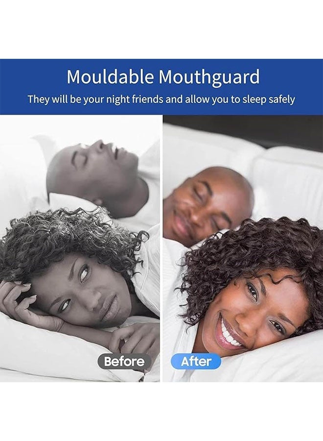 طقم واقي فم مكون من 4 قطع لصرير الأسنان أثناء الليل، واقي فم لطحن الأسنان أثناء الليل، واقي فم قابل لإعادة الاستخدام لطحن الأسنان، واقيات فم لطحن الأسنان (كبير، صغير) - Image 5