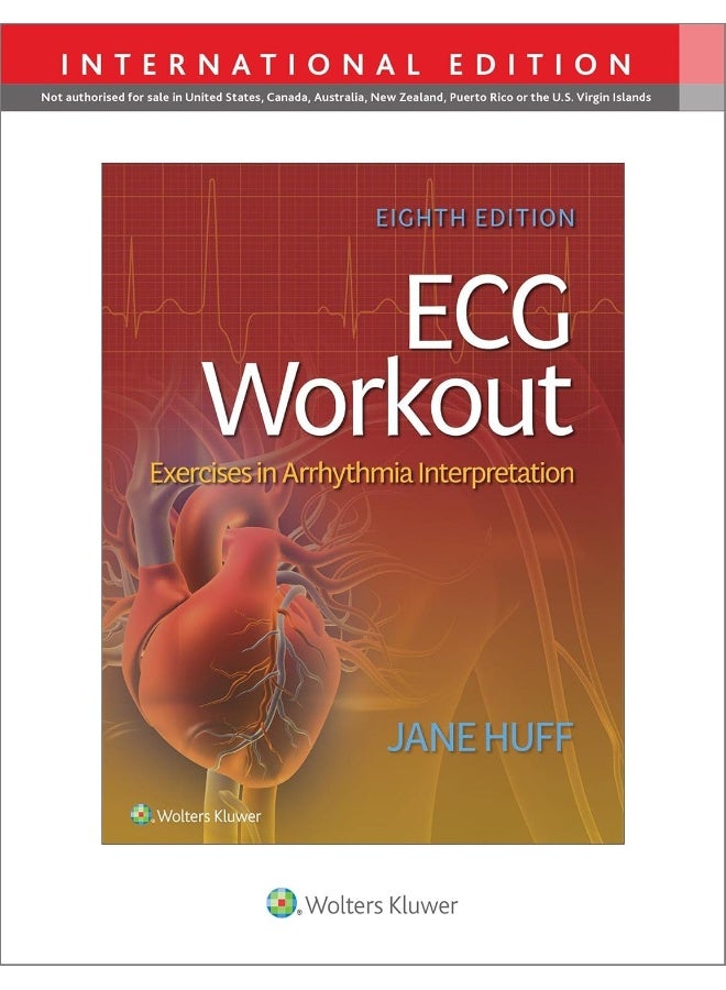 ECG Workout: Exercises in Arrythmia Interpretation 