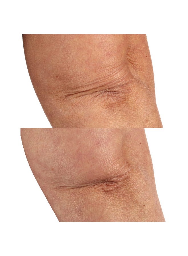 Perricone MD Essential Fx Acylglutathione Chia Body Oil 4 Oz. - Image 4