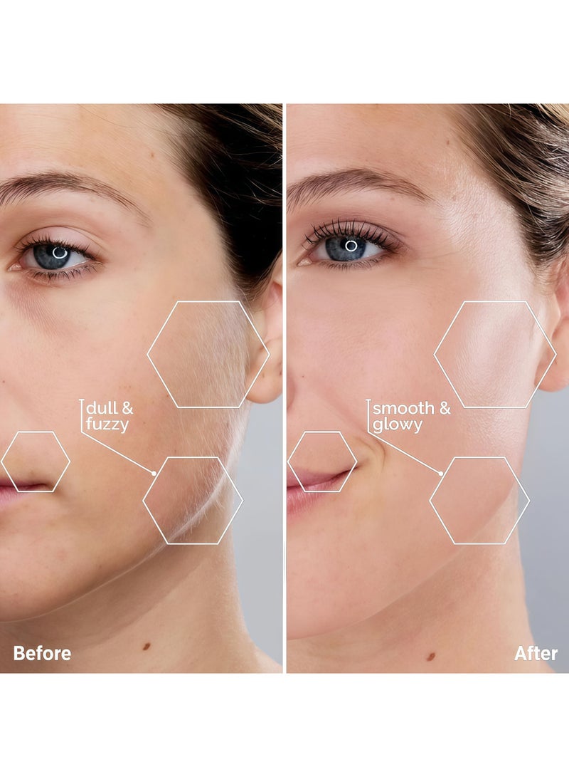 Lesha Facial Hair Removal for Women - Painless Epilator Facial Hair Remover with 2 Pcs Replacement Heads - USB Rechargeable Electric Hair Removal Device for Face Lips Arms Peach Fuzz with Light(Rose Gold) - Image 5