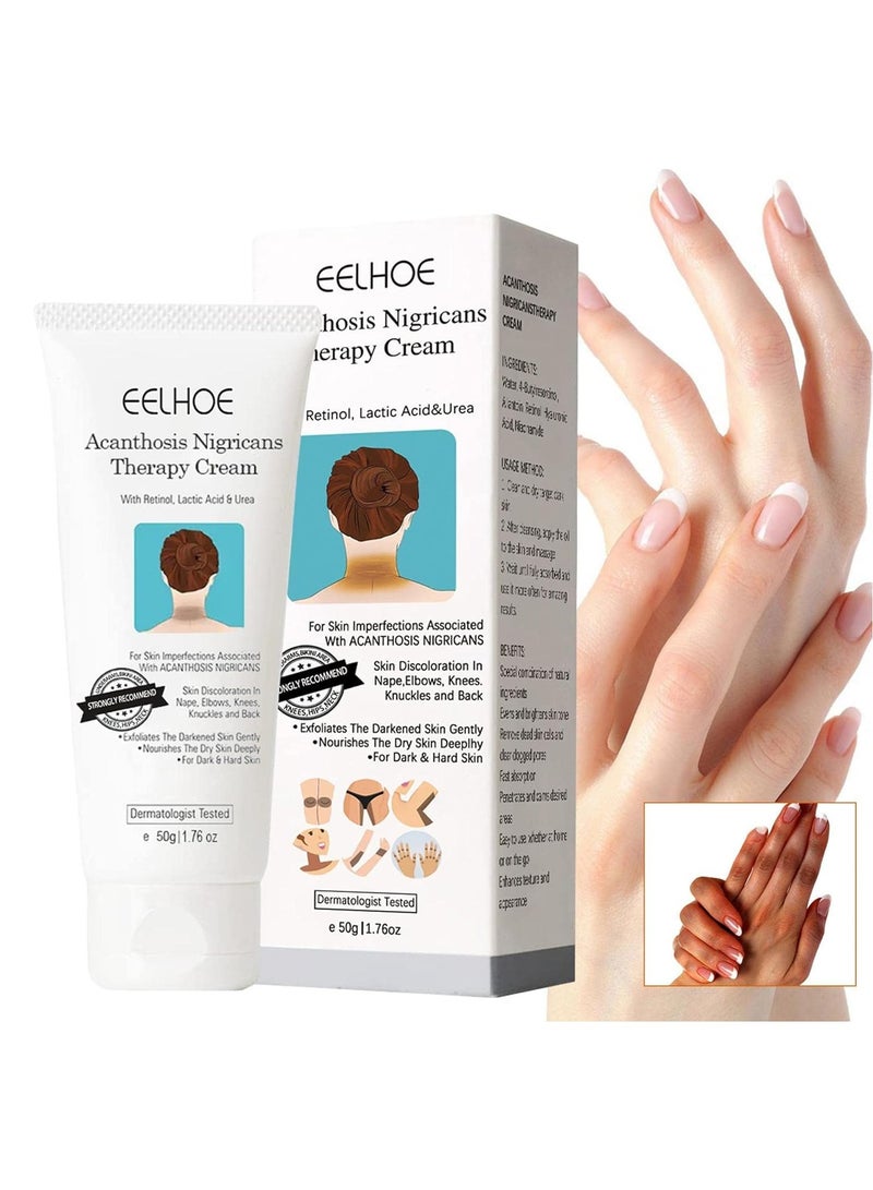 EELHOE Corrector Cream for Dark Spots - Face Acanthosis Nigricans Corrector Remover - 50g Body Skin Bleach For Women Elbow Knee Ankle Neck Dark Spots Corrector Lotion - Image 1