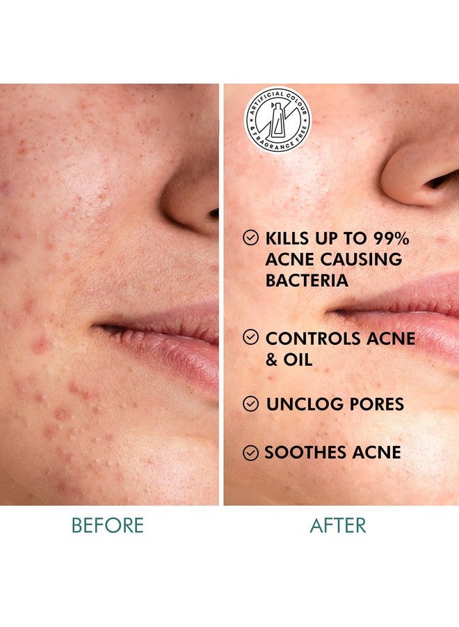 MCaffeine 2% حمض الساليسيليك والزنك Pca وشاي الماتشا مناديل تنظيف البشرة من حب الشباب، مصل تقشير مضاد لحب الشباب ومناديل تونر للبشرة المعرضة لحب الشباب، يفتح المسام ويتحكم في الزيوت وخالي من الكبريتات لكل من النساء والرجال 40 ن (X1) - Image 3