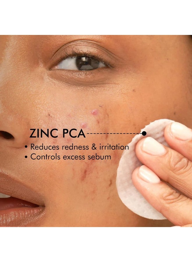 MCaffeine 2% حمض الساليسيليك والزنك Pca وشاي الماتشا مناديل تنظيف البشرة من حب الشباب، مصل تقشير مضاد لحب الشباب ومناديل تونر للبشرة المعرضة لحب الشباب، يفتح المسام ويتحكم في الزيوت وخالي من الكبريتات لكل من النساء والرجال 40 ن (X1) - Image 5