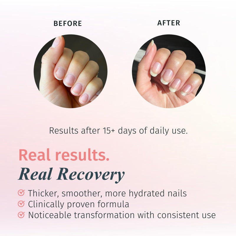duri Rejuvacote 1 Nail Growth System and duri Drop'n Go Polish Drying Drops Combo - Image 2
