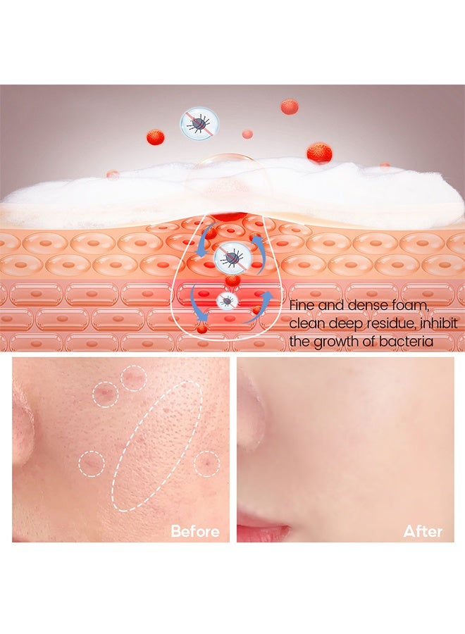 Vibrant Glamour Salicylic Acid Acne Soap 100g, Pore Exfoliating Softening Skin Face Deep Cleansing Body Wash Bath Soap Salicylic Acid Acne Treatment Soap - Image 3