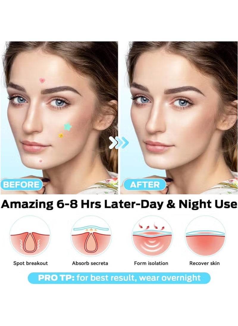 ميأميأ 200 Counts Acne Pimple Patch, Acne Covering Stickers for Face and Skin, Pimple Patch Daily Skin Care  - Image 3