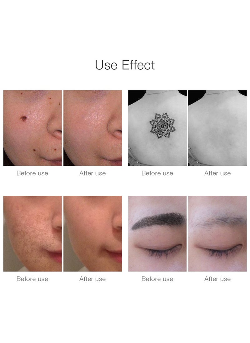 Lescolton - Laser Tattoo Removal Machine Picosecond pen Freckle Remover Mole Dark Spot Eyebrow ment Acne blue light Treatment - Image 1