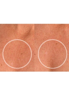 Sio SiO Beauty ChestLift Anti-Wrinkle Patches (2 Weeks Supply) - Reusable Overnight Smoothing Decollete Pad - Anti-Aging Silicone Patch For Neck & Cleavage - Hydrate, Tighten & Rejuvenate  - Image 3