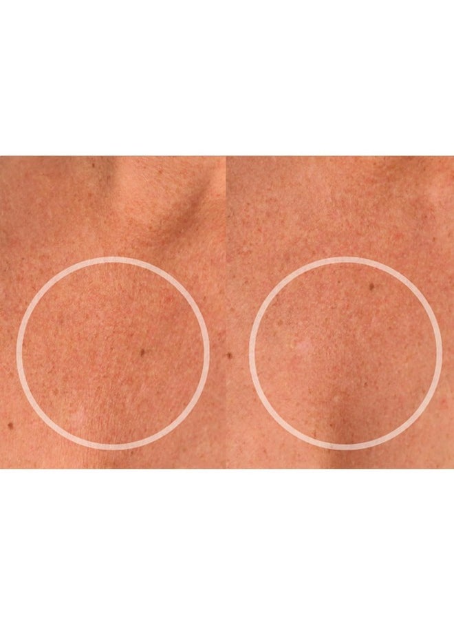 Sio SiO Beauty ChestLift Anti-Wrinkle Patches (2 Weeks Supply) - Reusable Overnight Smoothing Decollete Pad - Anti-Aging Silicone Patch For Neck & Cleavage - Hydrate, Tighten & Rejuvenate  - Image 3