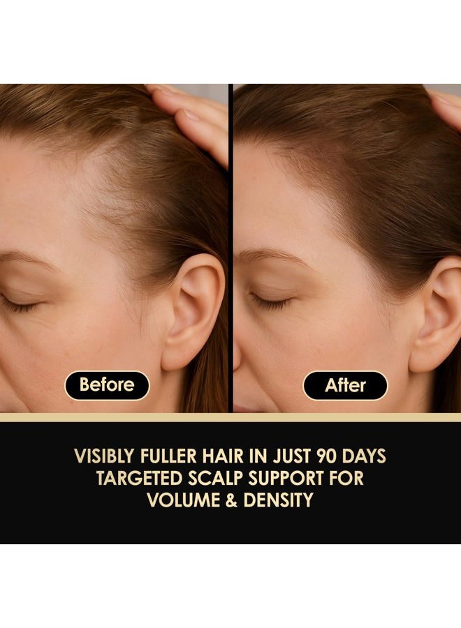 ThickTails Hair Growth Serum for Women – Biotin + Caffeine Lightweight Scalp Serum for Fine or Thinning Hair – Supports Fuller-Looking, Stronger-Feeling Hair – 100ml - Image 2