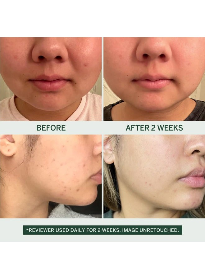 FACETORY Urban Calm Purifying Gel Facial Cleanser - Hydrating Face Wash with Fermented Pear & Capryloyl Salicylic Acid LHA - Gentle Exfoliating Foam Cleansing Gel for All Skin Types - Image 3