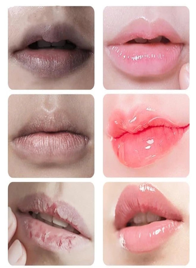 Lip Serum with Vitamin Extract, Lip Lightening Treatment for Dark Lips, Brightener for Smokers & Non-Smokers - Image 2