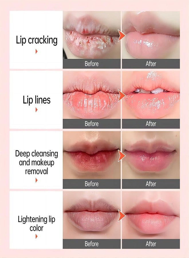 Lip Serum with Vitamin Extract, Lip Lightening Treatment for Dark Lips, Brightener for Smokers & Non-Smokers - Image 4