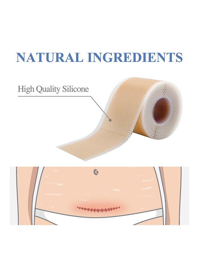 SOUTH MOON - 1 Piece Silicone Scar Table - Scar Silicone Strip - Breathable Silicone Tape - Thin Silicone Scar Tape (1.5" * 59" per roll) - Image 1
