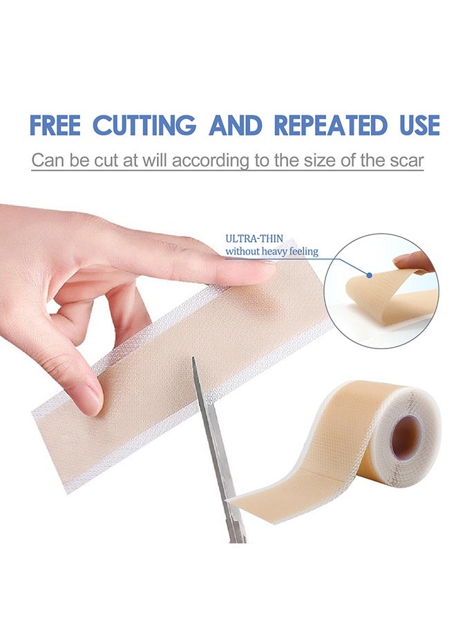 SOUTH MOON - 1 Piece Silicone Scar Table - Scar Silicone Strip - Breathable Silicone Tape - Thin Silicone Scar Tape (1.5" * 59" per roll) - Image 1