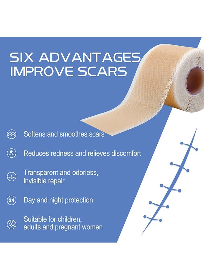 SOUTH MOON - 1 Piece Silicone Scar Table - Scar Silicone Strip - Breathable Silicone Tape - Thin Silicone Scar Tape (1.5" * 59" per roll) - Image 1
