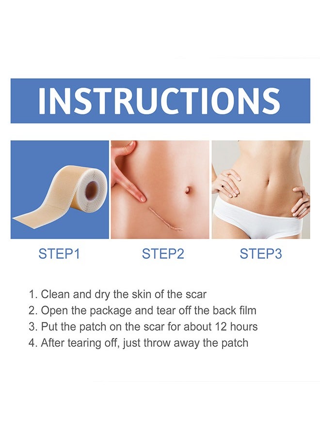 SOUTH MOON - 1 Piece Silicone Scar Table - Scar Silicone Strip - Breathable Silicone Tape - Thin Silicone Scar Tape (1.5" * 59" per roll) - Image 1