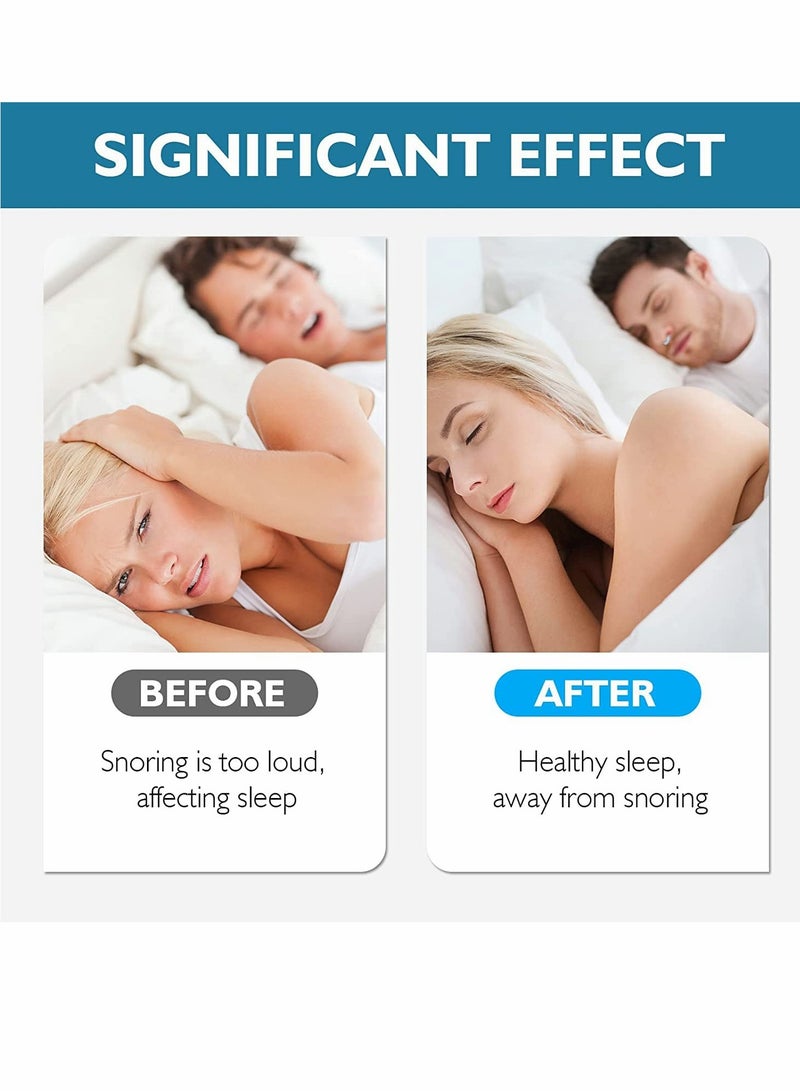 SYOSI جهاز إيقاف الشخير كليبل - جهاز مضاد للشخير - مشبك أنف سيليكوني - موسع أنفي مغناطيسي - يوفر الحل الفعال لإيقاف 4 قطع - Image 2