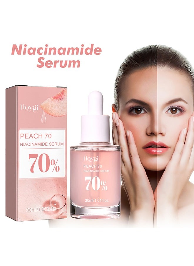 Peach 70 Niacinamide Serum 70%,Brightening Face Serum 30ml - pzsku/Z4831B42425C5F183EA8AZ/45/_/1736336530/64613362-3f0c-4d07-a931-b894f6a70081