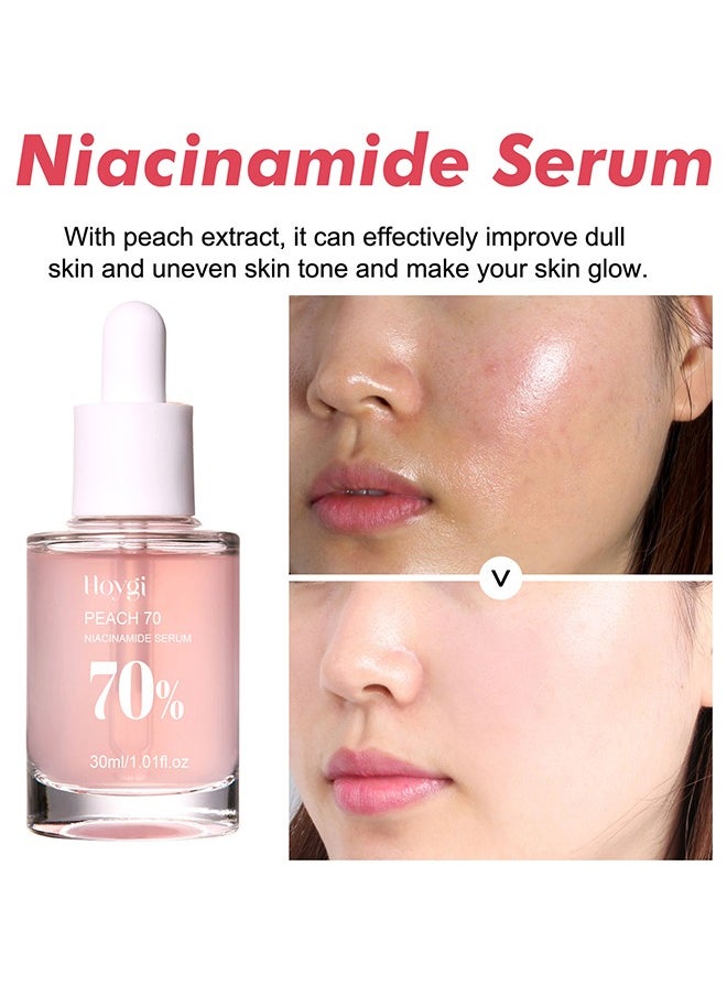 Peach 70 Niacinamide Serum 70%,Brightening Face Serum 30ml - pzsku/Z4831B42425C5F183EA8AZ/45/_/1736336549/b90be320-f841-426a-84a6-2388bbc3f5fc