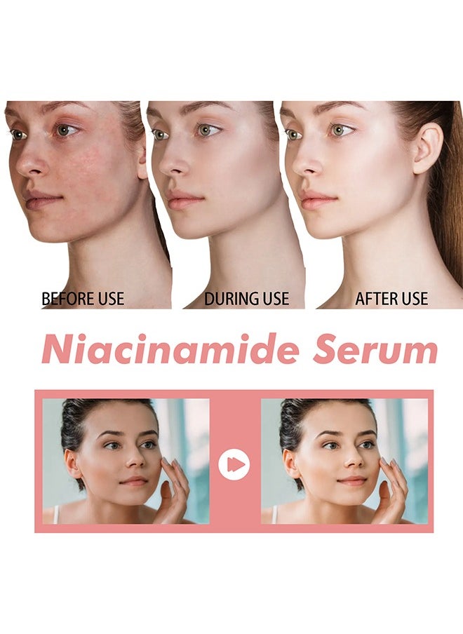 Peach 70 Niacinamide Serum 70%,Brightening Face Serum 30ml - pzsku/Z4831B42425C5F183EA8AZ/45/_/1736336657/8e4946d6-4930-4135-8d0e-3c1c888237fa