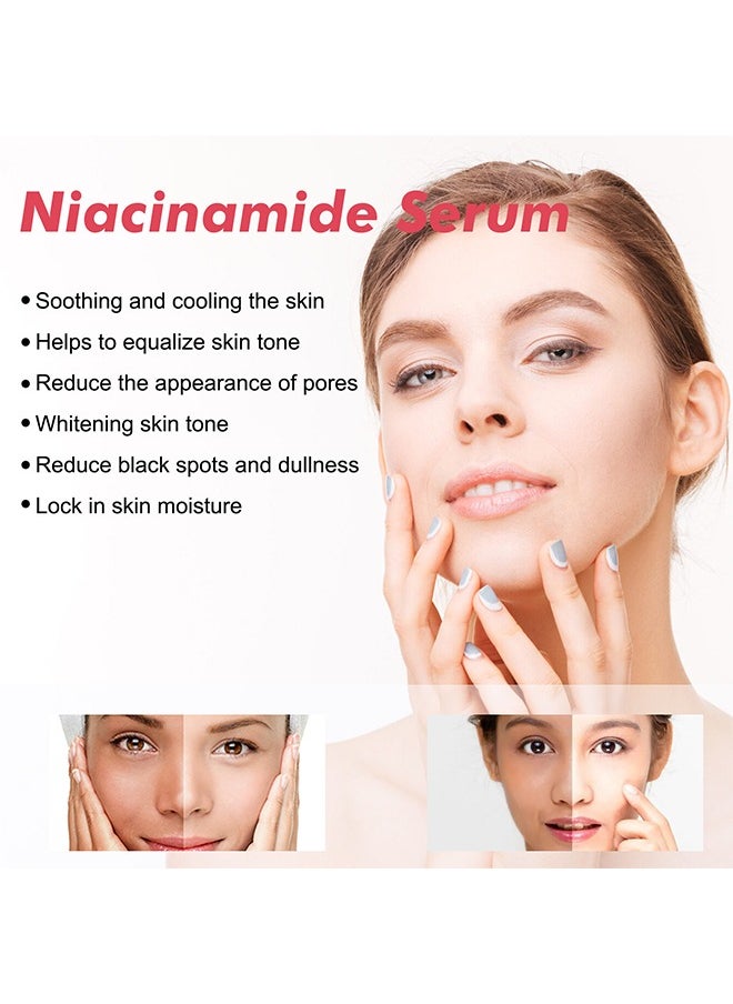 Peach 70 Niacinamide Serum 70%,Brightening Face Serum 30ml - pzsku/Z4831B42425C5F183EA8AZ/45/_/1736336694/c312d512-6979-4cc6-8758-db1387f4cb95