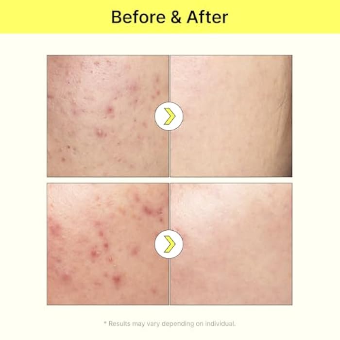 TIA'M TIAM Vita B3 Source, 1.35 fl oz, 10% Niacinamide Glow Serum with 2% Arbutin for Even Skin Tone and Dark Spot Care, Vegan Korean Skin Care - Image 4