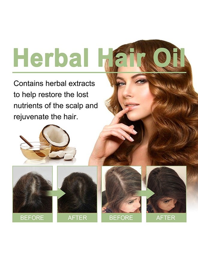 OUHOE - Adivasi Hair Oil,Original Hair Growth Oil 3 IN 1 Original Hair Adivasi Hair Growth Oil , with Natural Rosemary essential & Biotin for Control Hairfall anti dandruff 100ml - Image 1