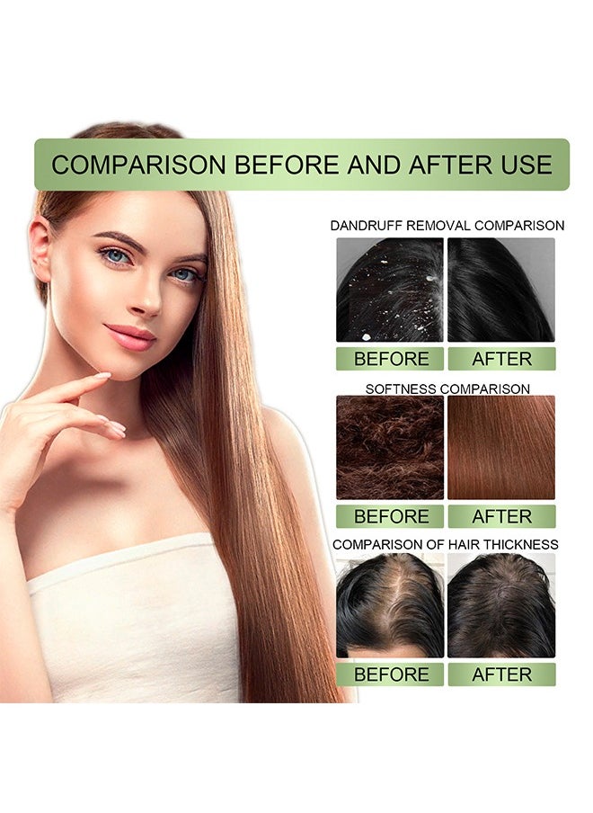 OUHOE - Adivasi Hair Oil,Original Hair Growth Oil 3 IN 1 Original Hair Adivasi Hair Growth Oil , with Natural Rosemary essential & Biotin for Control Hairfall anti dandruff 100ml - Image 1