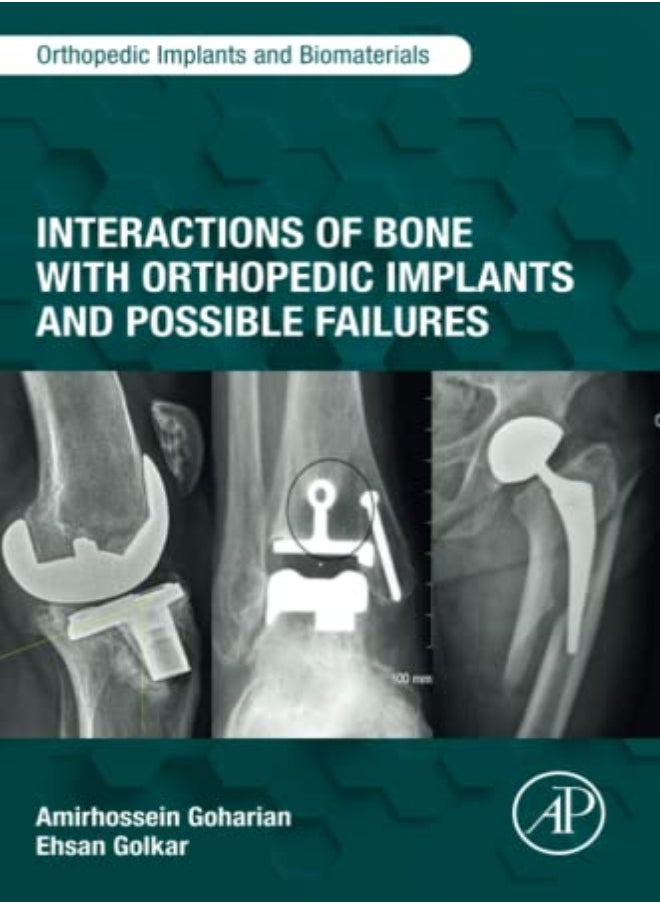 Interactions of Bone with Orthopedic Implants and Possible Failures 