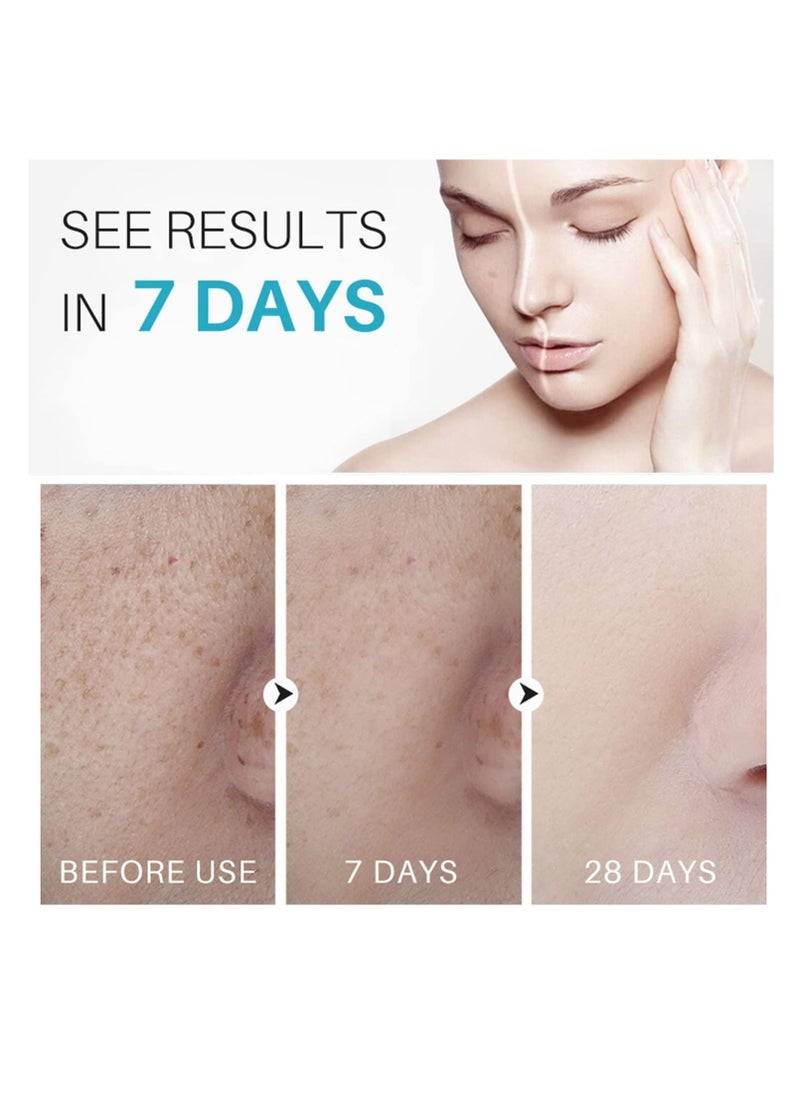 Lanthome - Dark Spot Remover for Face Hyperpigmentation Treatment Dark Spots, Melasma, Freckle, Sun Spots Removal Dark Spot Corrector Cream for Women and Men 30g - Image 1