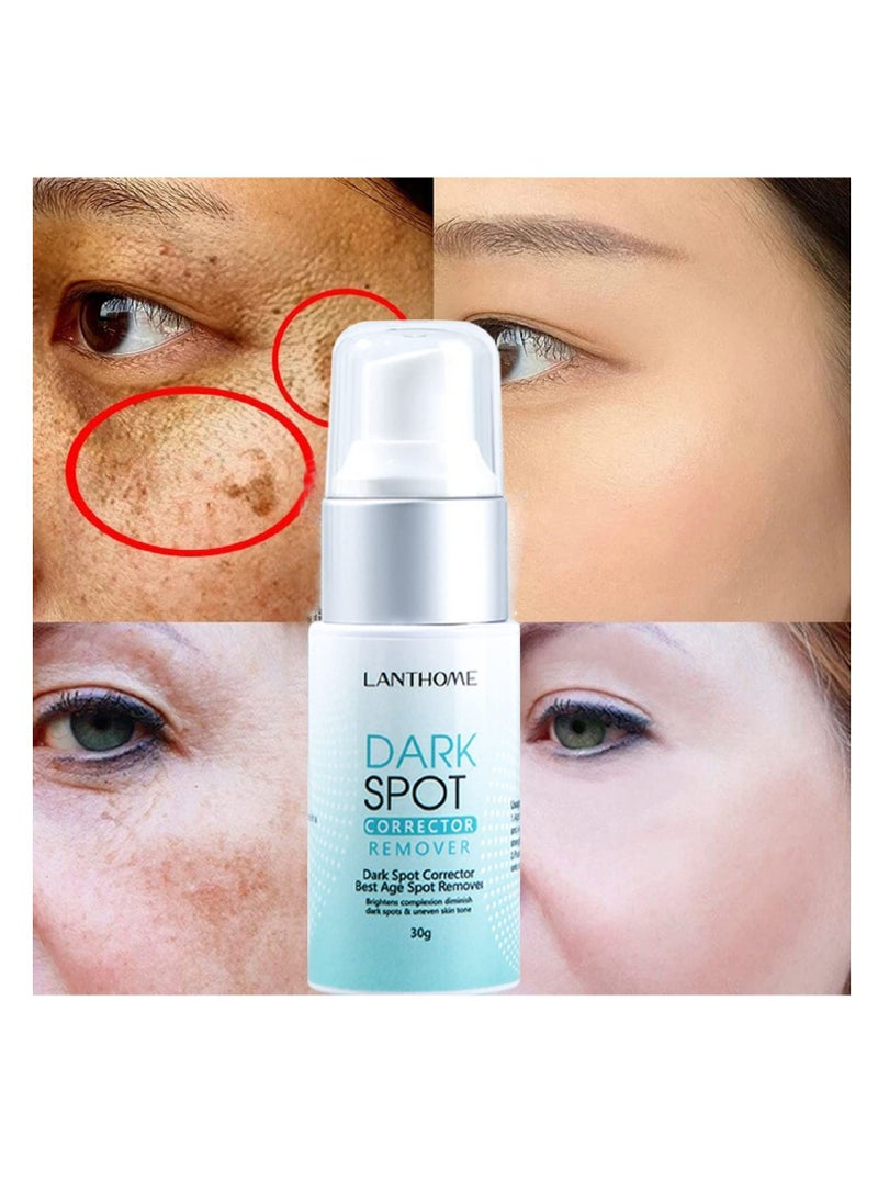 Lanthome - Dark Spot Remover for Face Hyperpigmentation Treatment Dark Spots, Melasma, Freckle, Sun Spots Removal Dark Spot Corrector Cream for Women and Men 30g - Image 1
