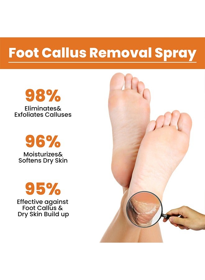 SOUTH MOON Foot Callus Removal Spray - Foot Callus Removal Spray - Instant Foot Peeling Spray - Foot Peeling Spray Oil - Foot Peeling Spray For Remove Dead Skin - Image 2