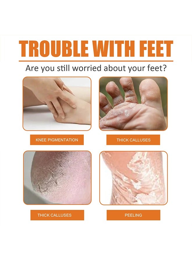 SOUTH MOON Foot Callus Removal Spray - Foot Callus Removal Spray - Instant Foot Peeling Spray - Foot Peeling Spray Oil - Foot Peeling Spray For Remove Dead Skin - Image 4