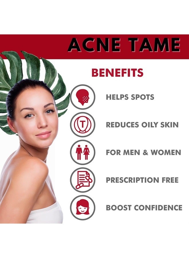 Acnetame Acne Tame- Acne Pills Supplement- Clear Skin Vitamins Pill for Oily Skin Treatment, Hormonal Blemishes, Anti Spots & Cystic Acnes Supplements for Women, Men, Teens & Adults- 60 Oral Tablets… - Image 4