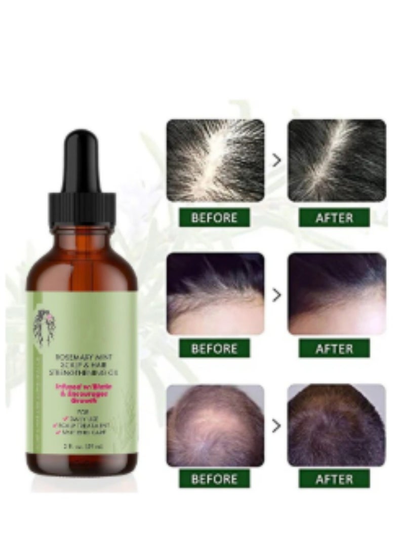 Generic Rosemary Mint Scalp & Hair Strengthening Oil Infused W/Biotin & Encourages Growth 59ml  - Image 1