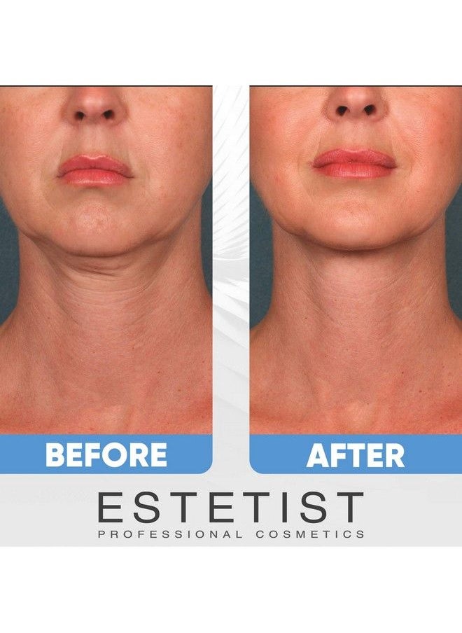 Estetist V Shaped Slimming Face Mask Double Chin Reducer Face Lift Tape Tightening Mask Anti Aging Anti Wrinkle Firming Jawline Slimmer (5 Pack)  - Image 3