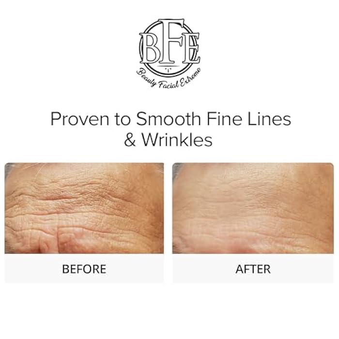 Beauty Facial Extreme Glycolic Acid 15% Anti-Aging Wrinkle Cream Reduces the Appearance of Fine Lines, Wrinkles, Age Spots, Dark Spots & Improves Dull Looking Complexion. Includes A.H.A & Green Tea Moisturizer. - Image 3