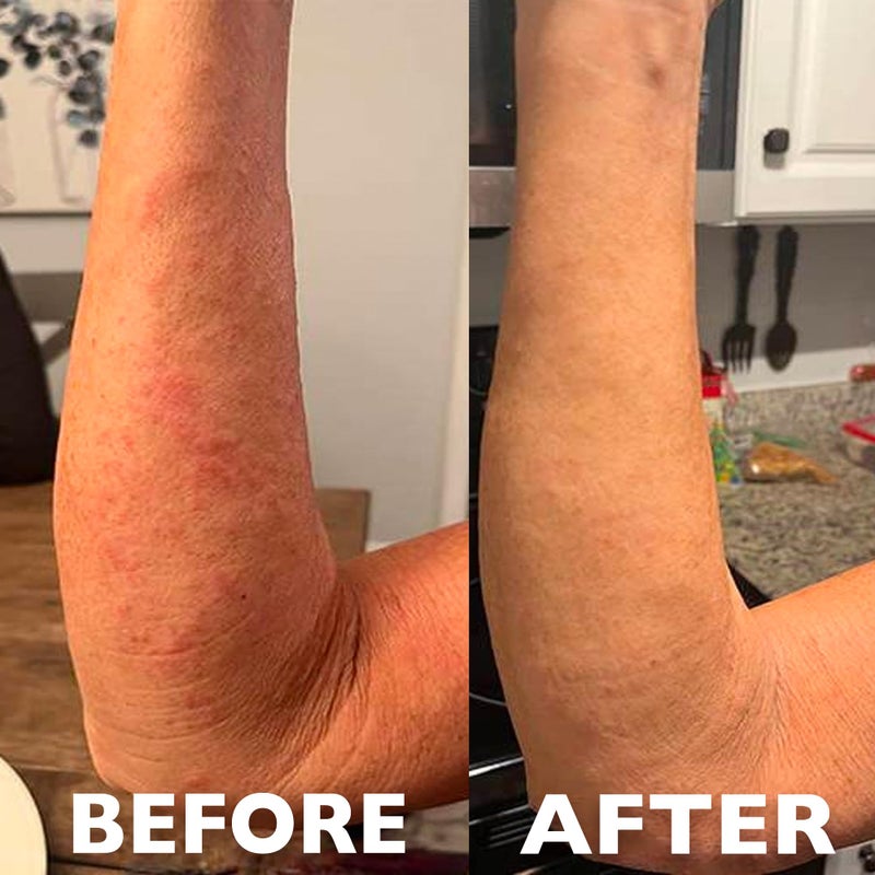 Hey Honey 911 Multi-purpose Pro Gel Instant Relief With Bee Propolis | Designed To Treat & Repair Compromised Skin At An Accelerated Rate | 99% Natural, Cruelty-Free & Clean Ingredients | 1 Oz - Image 4