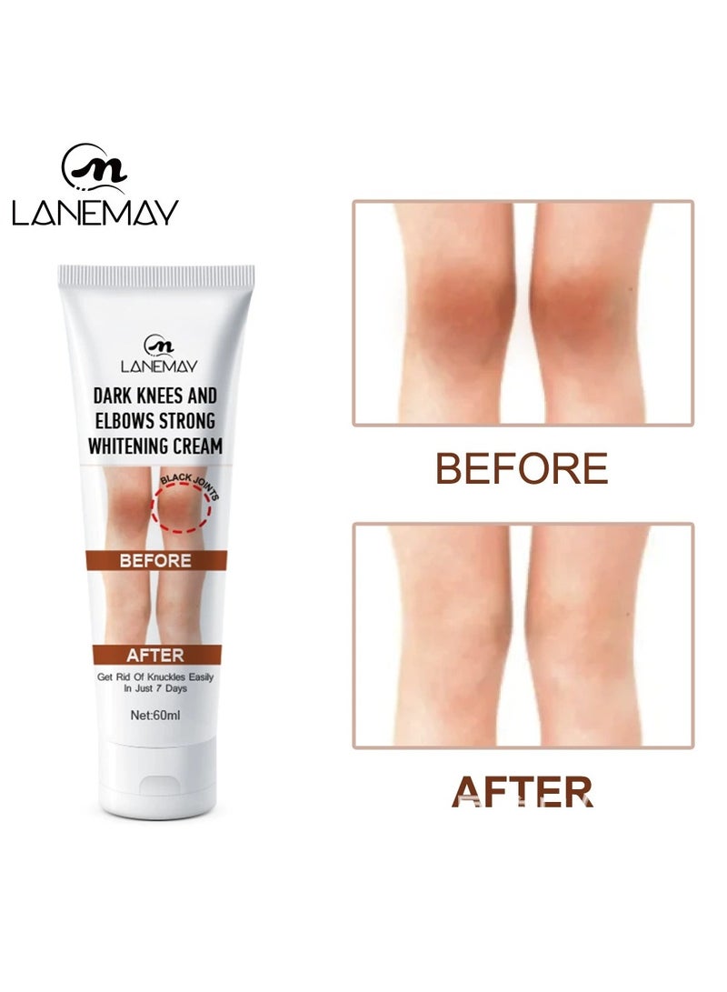 LANEMAY كريم تبييض الركبة والمرفقين – مرطب ومضيء لإزالة البقع الداكنة بلسم لتفتيح البشرة المشتركة، لون موحد - Image 1