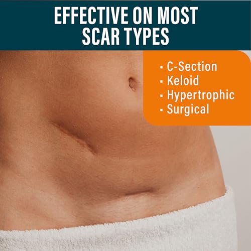 NUVADERMIS Silicone Scar Sheets – Extra Long Medical-Grade Scar Sheets for C-Section, Tummy Tuck, Keloid, and Surgical Scars – Reusable and Effective – Pack of 4 – Medium Tone - Image 3
