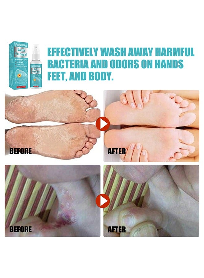 Jaysuing Anti Fungal Athletes Foot Spray- Prevent Athlete's Foot,Smelly Feet,Relieve Itching of Feet, Sweating, Peeling And Blisters, Natural Ingredients Foot Fungi Spray For Tinea Pedis 50ML - Image 3