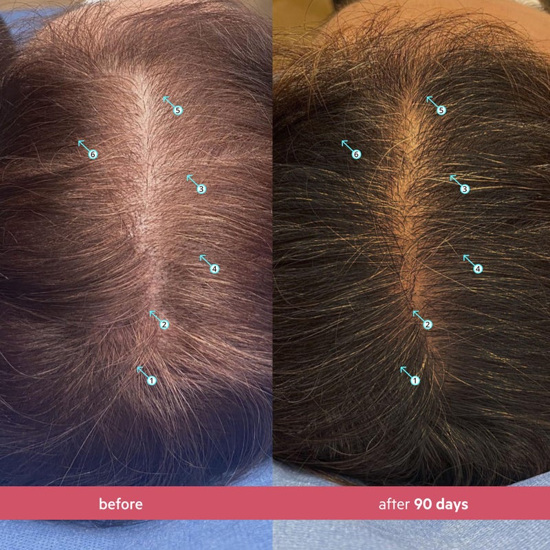 DS LABORATORIES DS Labs Spectral Womenâ€™s Hair Density Serum (formerly Spectral.CSF), 60mL - Lightweight Leave-In for Fuller, Thicker Looking Hair, Fast Absorbing, Non-Greasy, For All Hair Types (Pack of 3) - Image 3