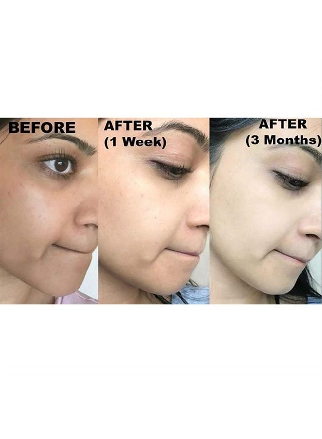 RELUMINS صابون تفتيح/تقشير فائق الجودة مع الجلوتاثيون، الأربيون، وحمض الكوجيك - 65 جرام - Image 3