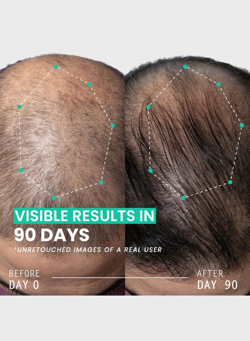 ازيل روتين تكثيف الشعر المزدوج - حل مضاد لتساقط الشعر لمدة 90 يوماً